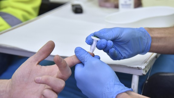 Prípadov HIV pribúda. Tu sú čísla za Slovensko s údajmi, ako sa infikovaní nakazili