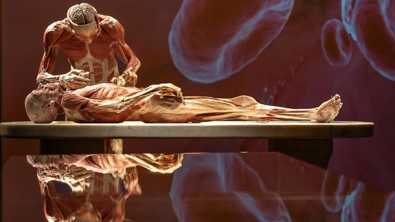 V Bratislave sa začne kontroverzná výstava ľudských tiel, dozorovať ju budú hygienici