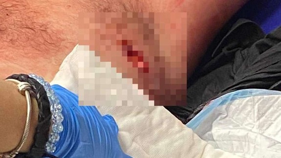 Rušno v obciach pri Bratislave: Muži sa bodali nožmi