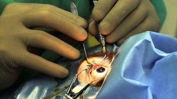 Z Nemocnice sv. Cyrila a Metoda budú naživo vysielať operácie očí