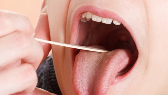 Alkohol, piercing a iné faktory, ktoré ohrozujú zdravie vašich zubov