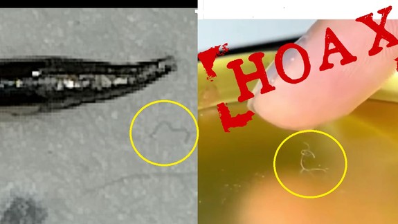 VIDEO: Ministerstvo zdravotníctva vysvetľuje, čo sú "hýbajúce sa vlákna" na respirátoroch...