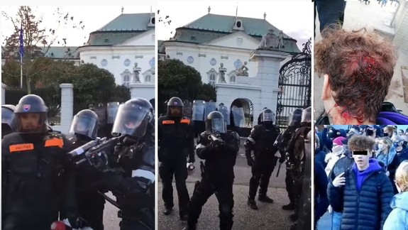 VIDEO: Pri proteste pred Úradom vlády policajti strieľali do davu - trafili pri tom do hlavy 15-ročného chlapca?