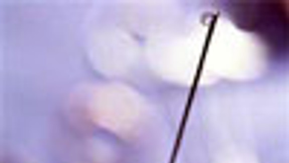 Muž striekačkou s omamnou látkou napadol dievča