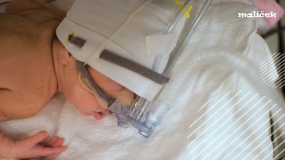 OZ Malíček: Opäť môžete prispieť na podporu predčasne narodených detí