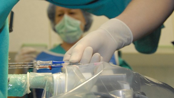 Výskyt rakoviny hrubého čreva a konečníka narastá u mladších ľudí