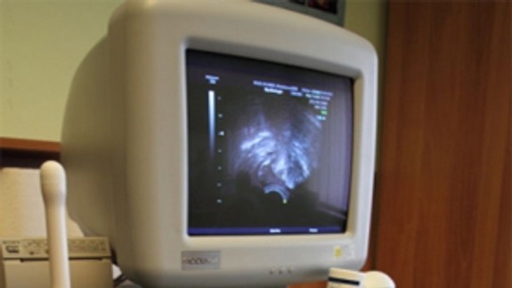 Neurologická klinika na Kramároch dostala nový sonograf