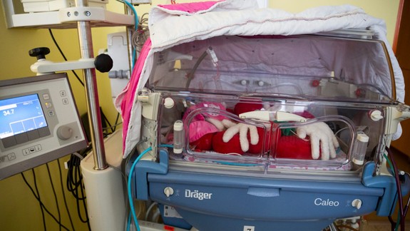 Na Slovensku sa minulý rok predčasne narodilo 3877 detí