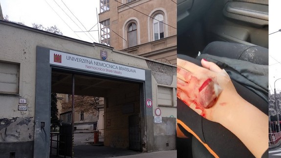 ANKETA: Takto vyzerala ruka mladej ženy po ošetrení v nemocnici na Mickiewiczovej - je to podľa vás v poriadku?