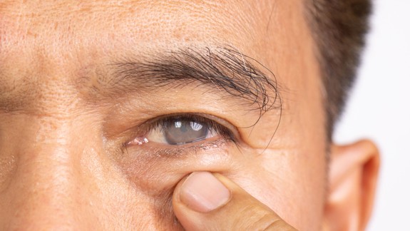 Rozlúčte sa so zahmleným videním – operácia sivého zákalu zaručí nový zrak