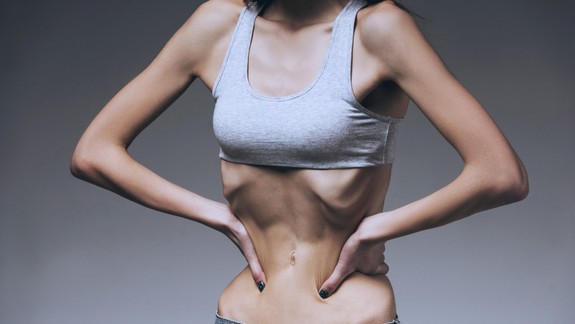 Je anorexia len módny výstrelok alebo smrteľná choroba?