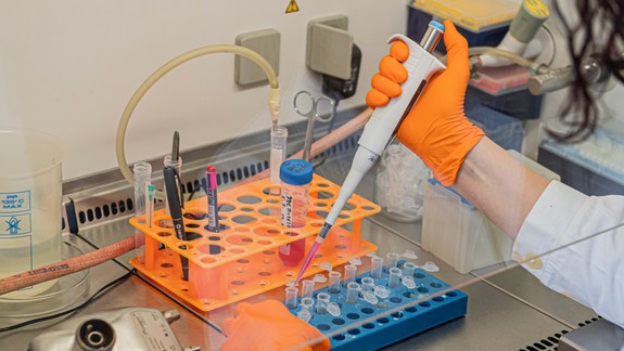 Koronavírus: Testy budú dostupnejšie, možno vzniknú aj mobilné odberové centrá