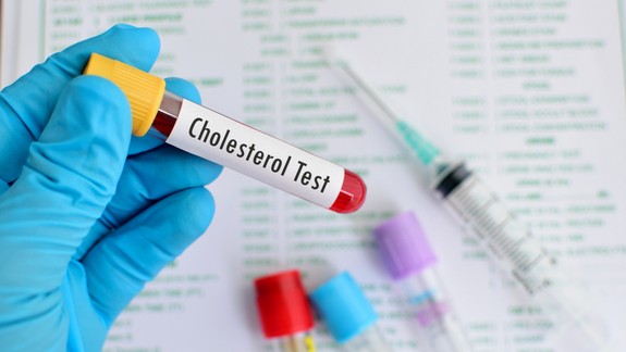 Nebezpečný cholesterol: Tuk, ktorý dokáže zabíjať