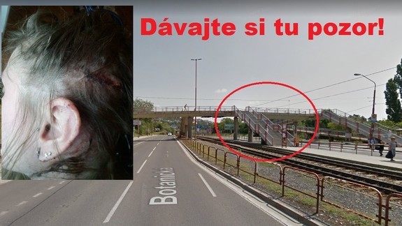 FOTO: Mladá žena si rozbila hlavu na rozbitom schodisku lávky pri zastávke MHD na Botanickej ulici