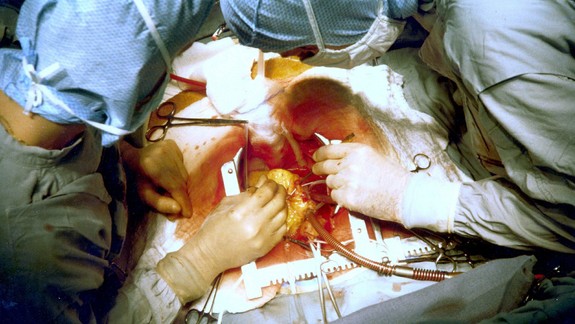 Ľudí viac straší rakovina, ochorenie srdca podceňujú