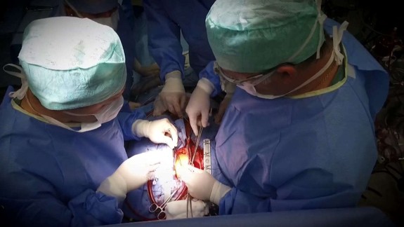 Na Slovensku si pripomíname 25. výročie prvej transplantácie srdca