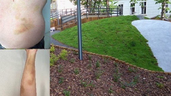 Úder teleskopickou tyčou, kopanec do hlavy: Partia agresorov napadla v Starom Meste skupinu homosexuálov