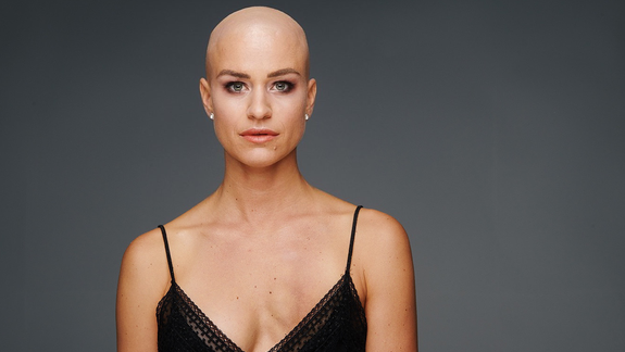 Bratislavčanka Lívia (32) podrobne o svojom boji s rakovinou prsníka: Vlasy mi vypadali na narodeninovej oslave