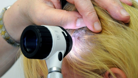 Dermatológovia budú opäť radiť na Trhu kože