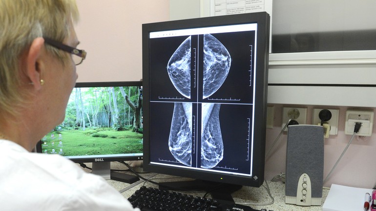 mamografia vyšetrenie