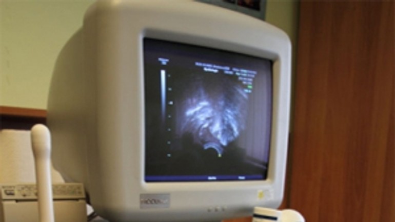 Neurologická klinika na kramároch dostala nový sonograf - Sonograf