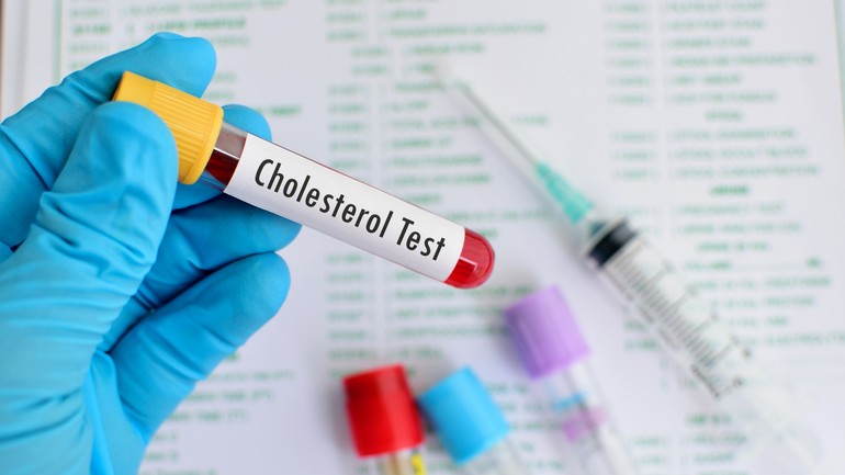 Cholesterol test