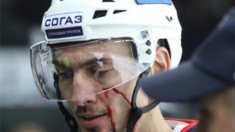 Zranenie šatana vážnejšie ako sa predpokladalo - Satan zraneny